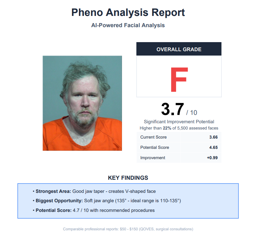 Bro Team Pill tweet media