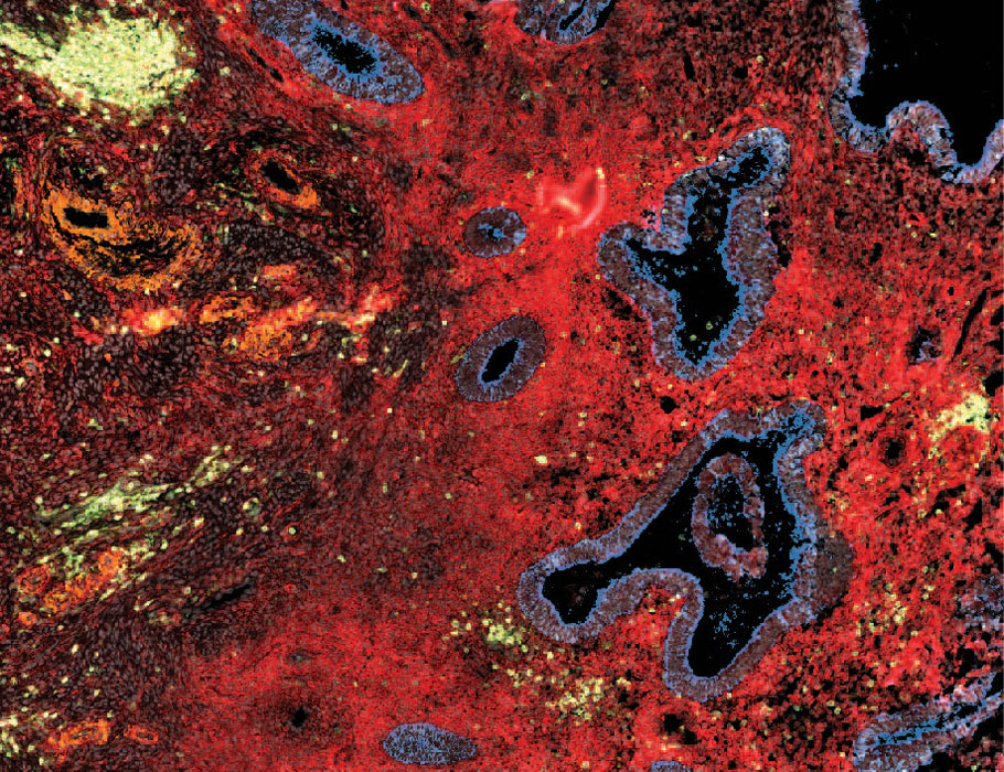 Science Translational Medicine tweet media