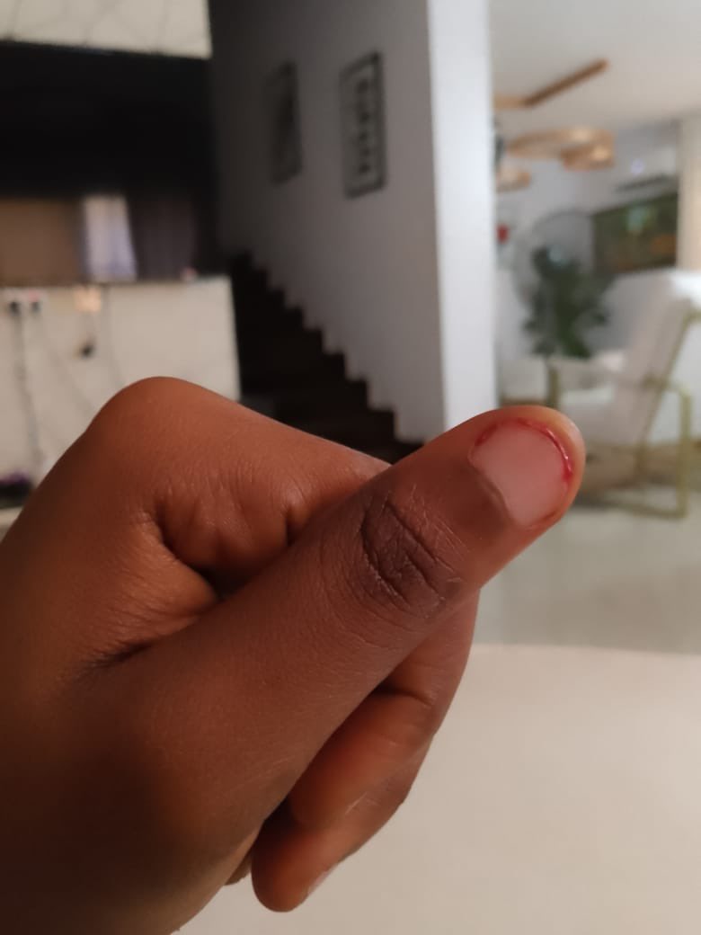 𝓞𝓶𝓪 🎀 tweet media