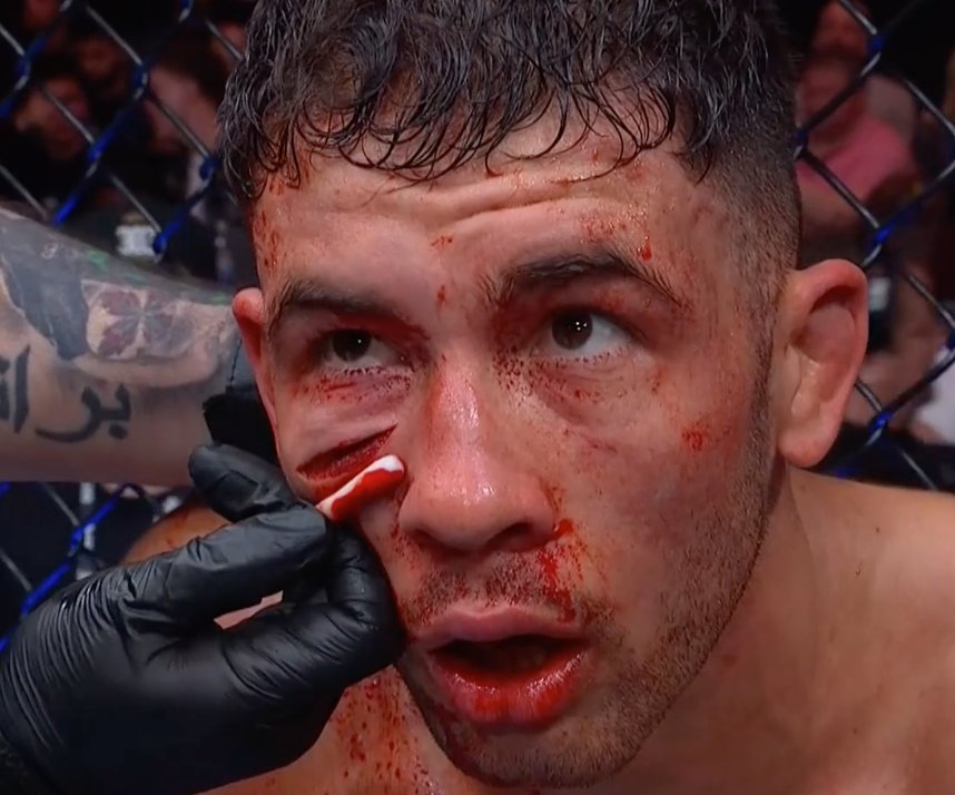 LaSueur_off's tweet photo. 😰

#UFCLondon https://t.co/9UpzE4U7ww