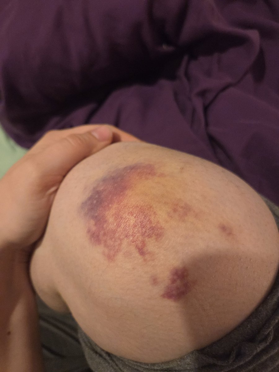 Бульбулятозавр🇺🇦🪴🌻 tweet media