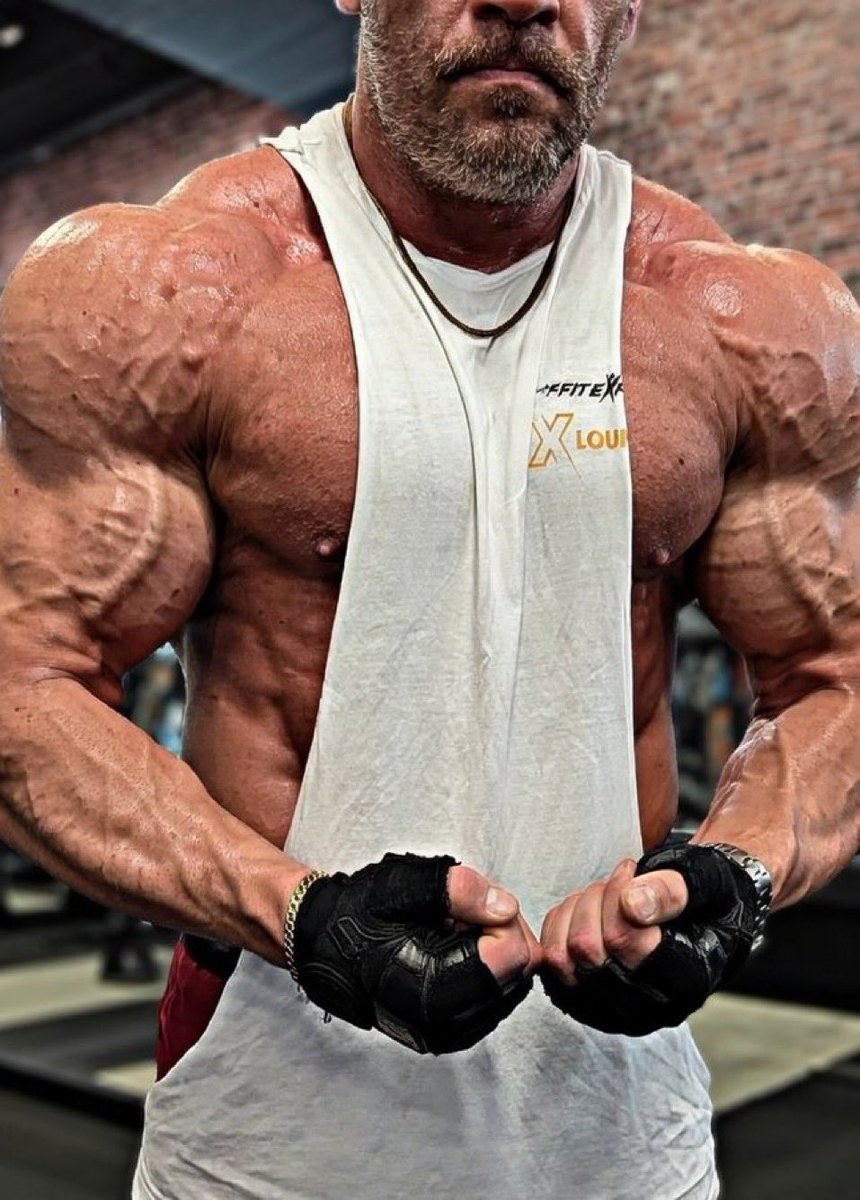 Ace Bannon tweet media