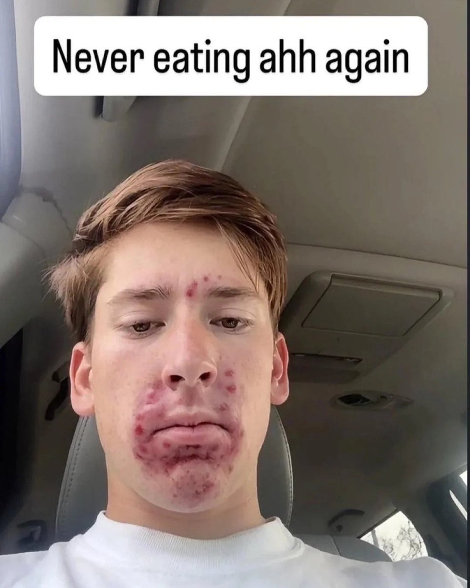 airdropesc tweet media