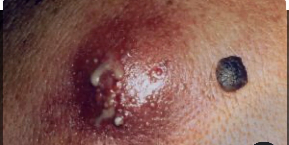 Backfire tweet media