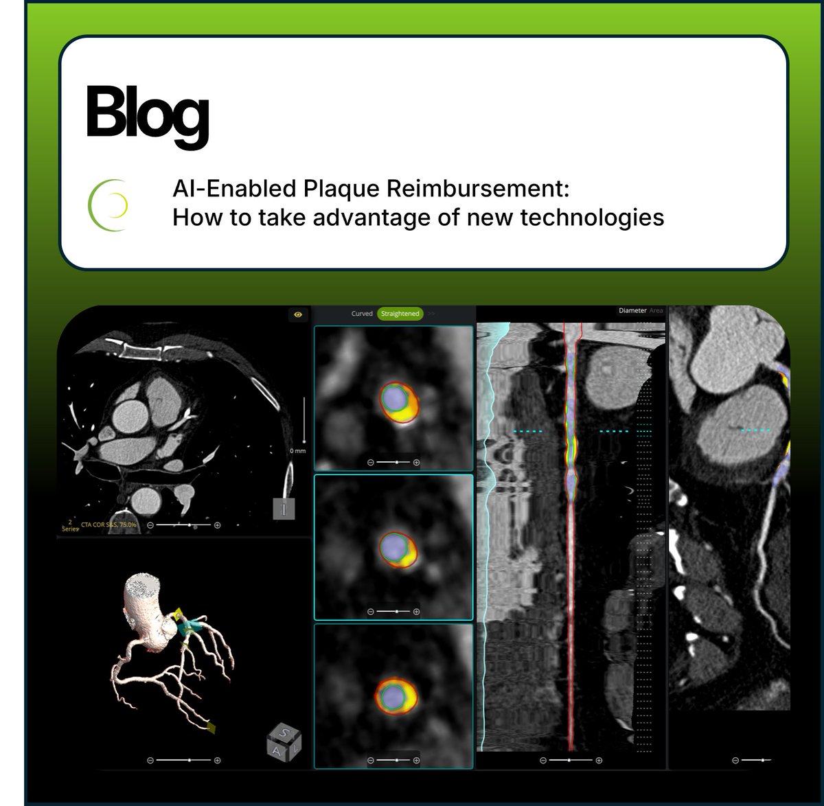 Circle Cardiovascular Imaging tweet media