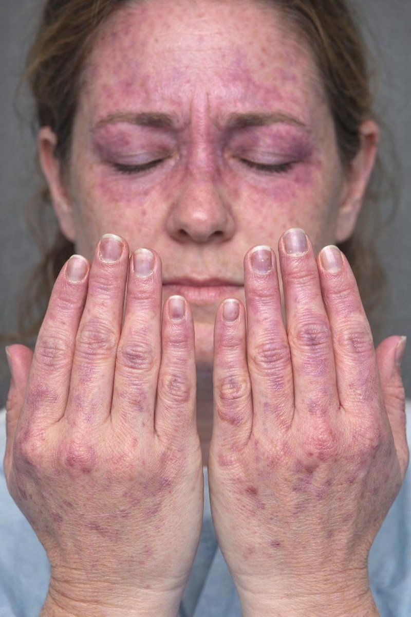 Dr Ihab Suliman tweet media