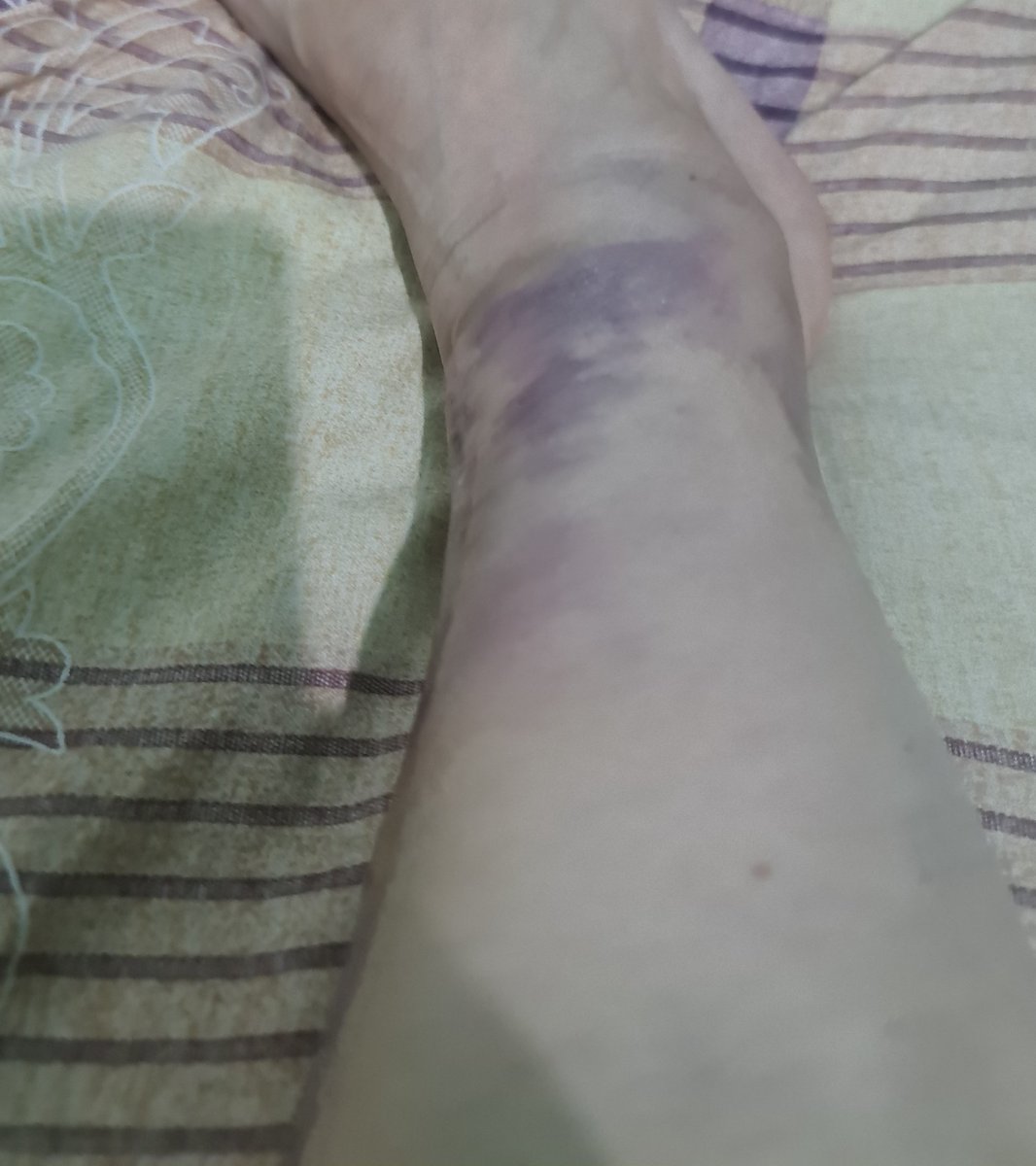 ➹💛Keykey🖤➷ ⭐🔟⭐ tweet media