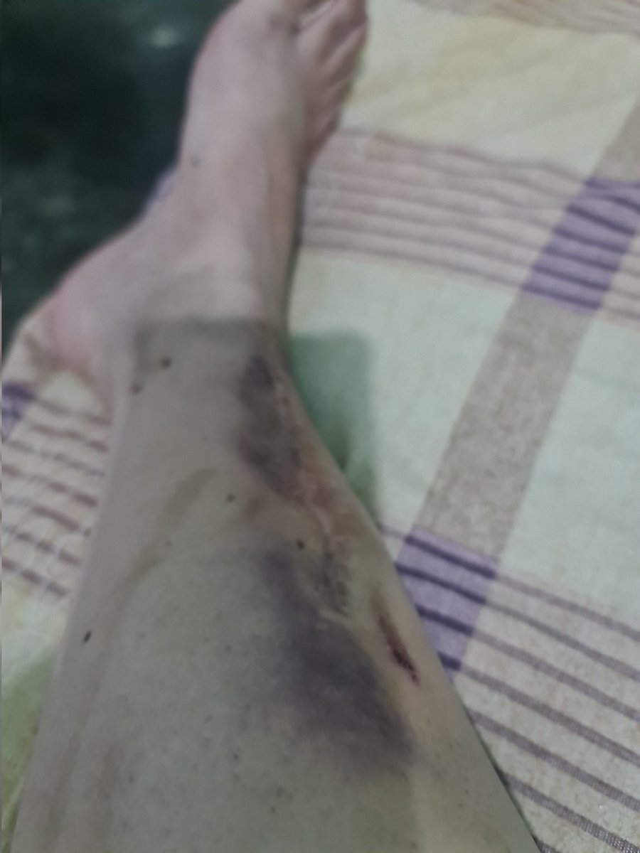 ➹💛Keykey🖤➷ ⭐🔟⭐ tweet media