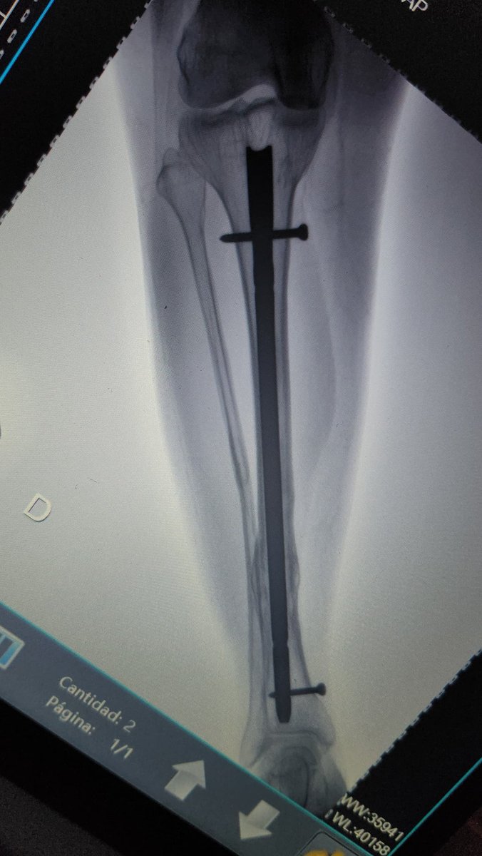 ➹💛Keykey🖤➷ ⭐🔟⭐ tweet media