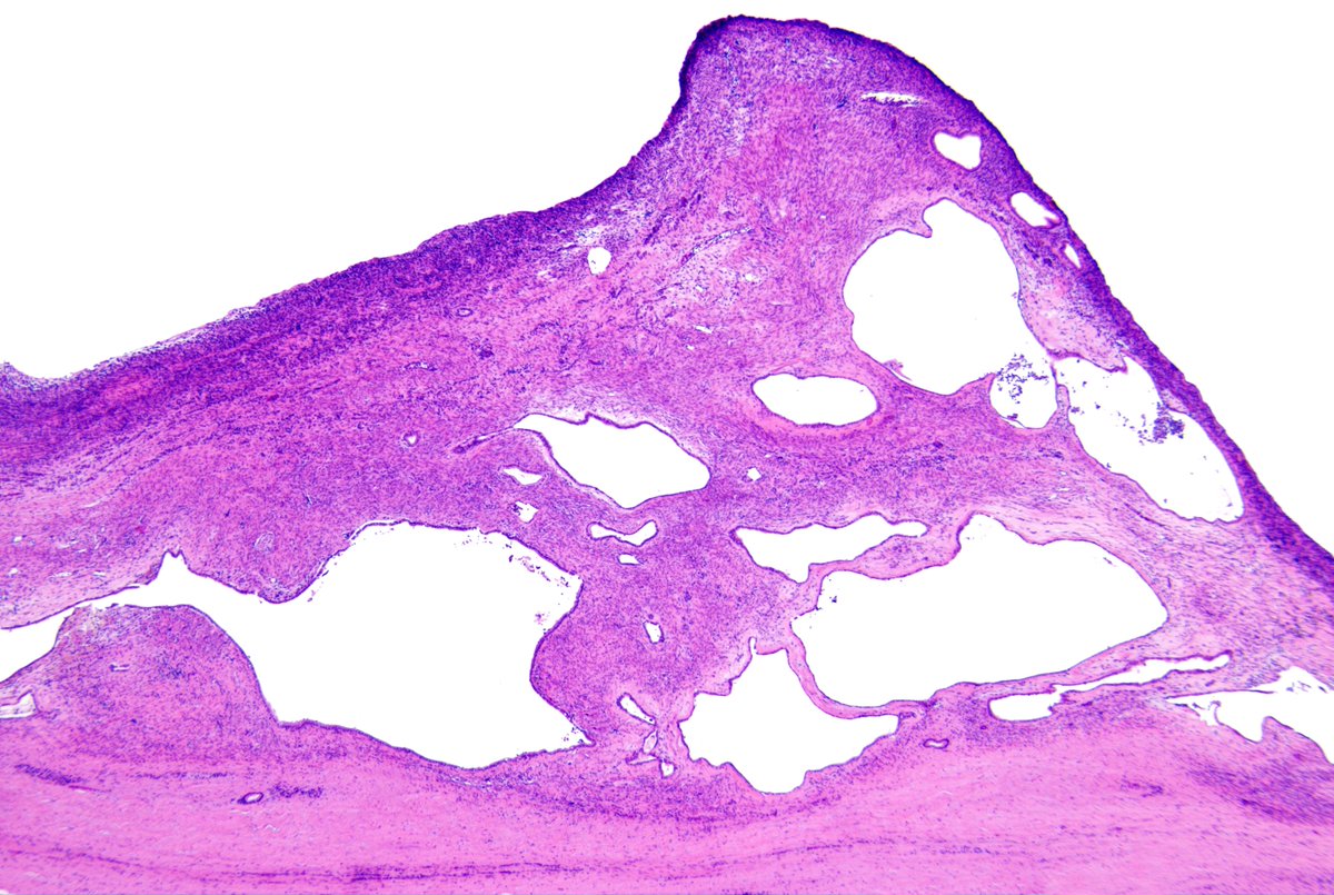 Pathology Walker@Auto Tweet Bot tweet media