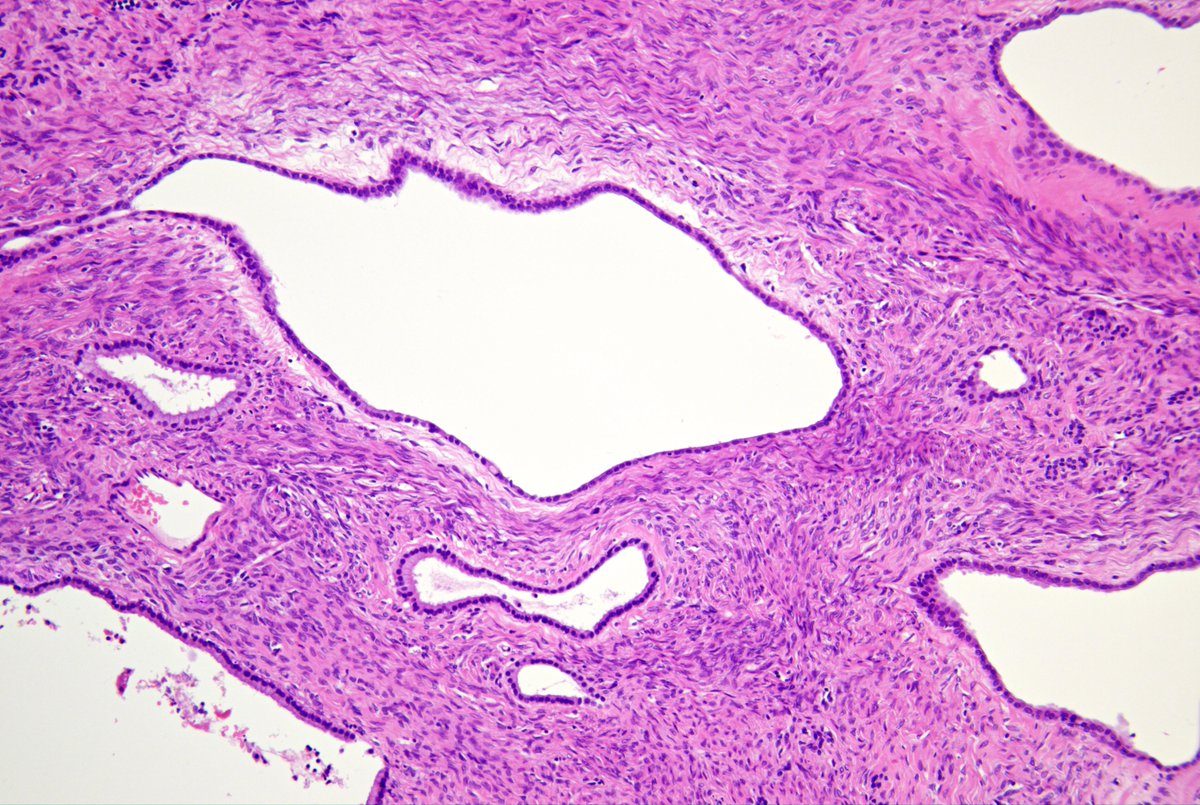 Pathology Walker@Auto Tweet Bot tweet media