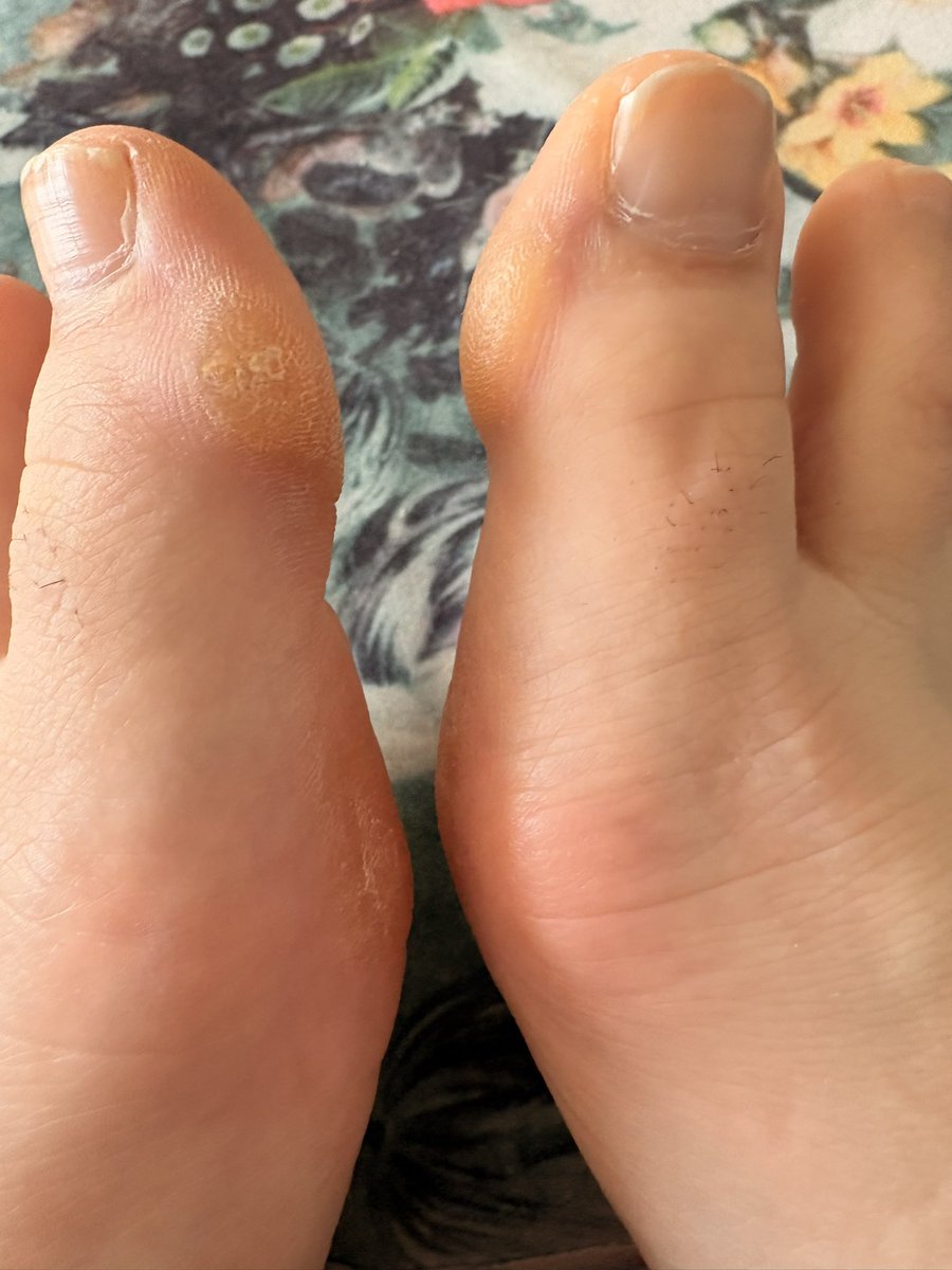 felines_feet's tweet photo. Message me for more pics of my cute feet! #feet #feetfetısh #feetworshi̇p #foot #footfetısh #feetِ https://t.co/bujY4qMn5e