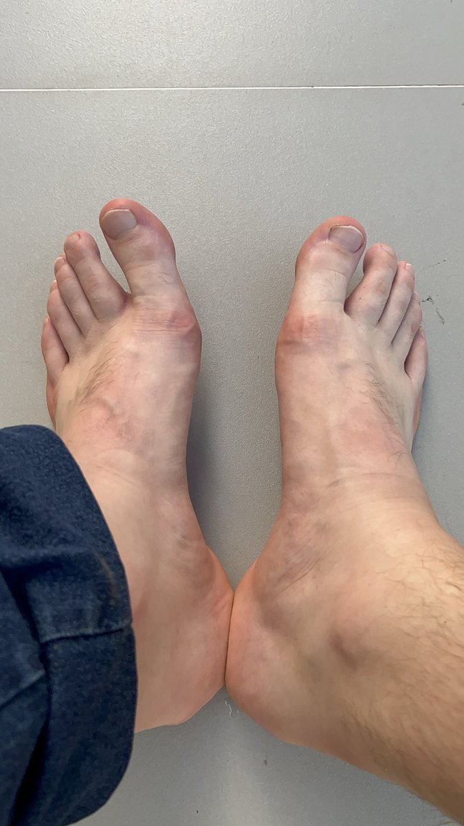 CasaldeBotas's tweet photo. Depois de um dia intenso de trabalho na fazenda, pensa no cheiro nestes pés 🦶🏻 44 https://t.co/sjeG8vJHGq