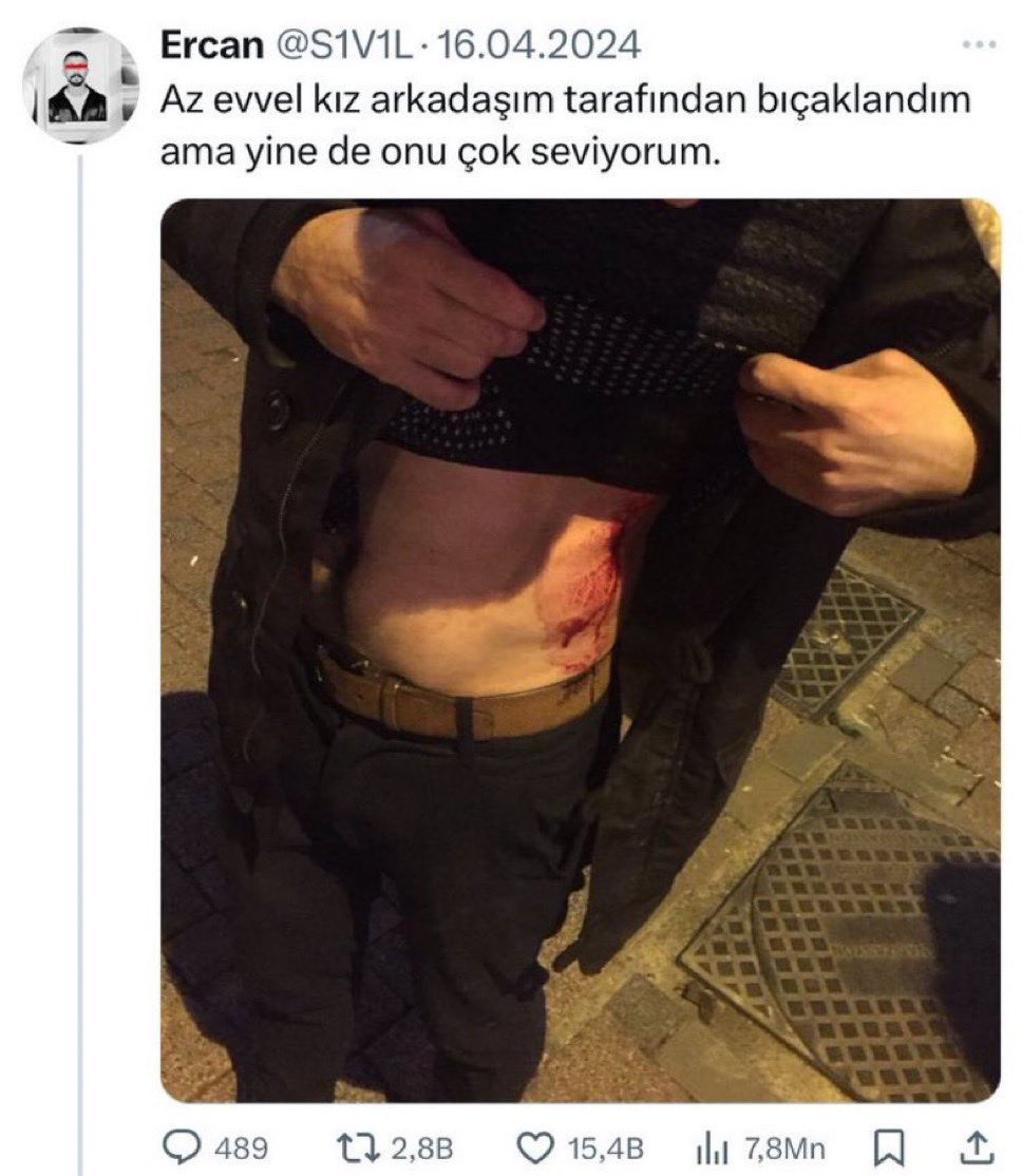 qhalidibnwaleed's tweet photo. istek değil

ihtiyaç https://t.co/U1dBQEzDJq