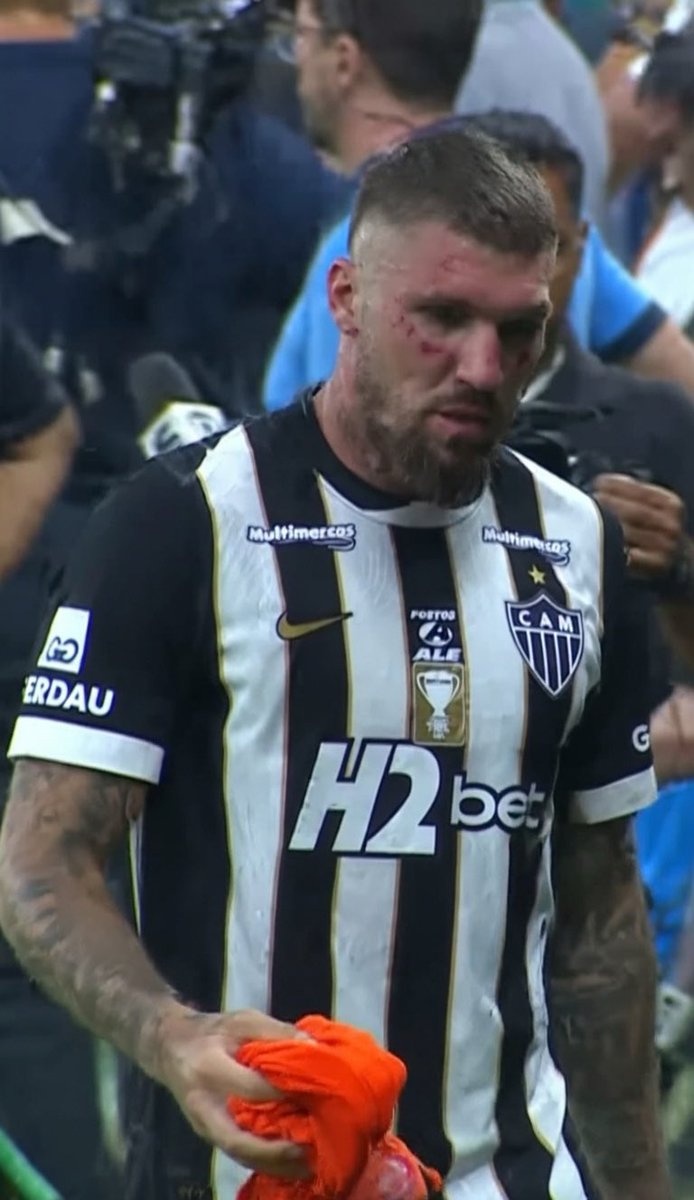 Vi várias torcidas do Brasil comemorando o LINCHAMENTO sofrido pelo Lyanco ontem.

Flamenguistas, São Paulinos, Botafoguenses…

O que o Ly fez pra ser tão odiado?