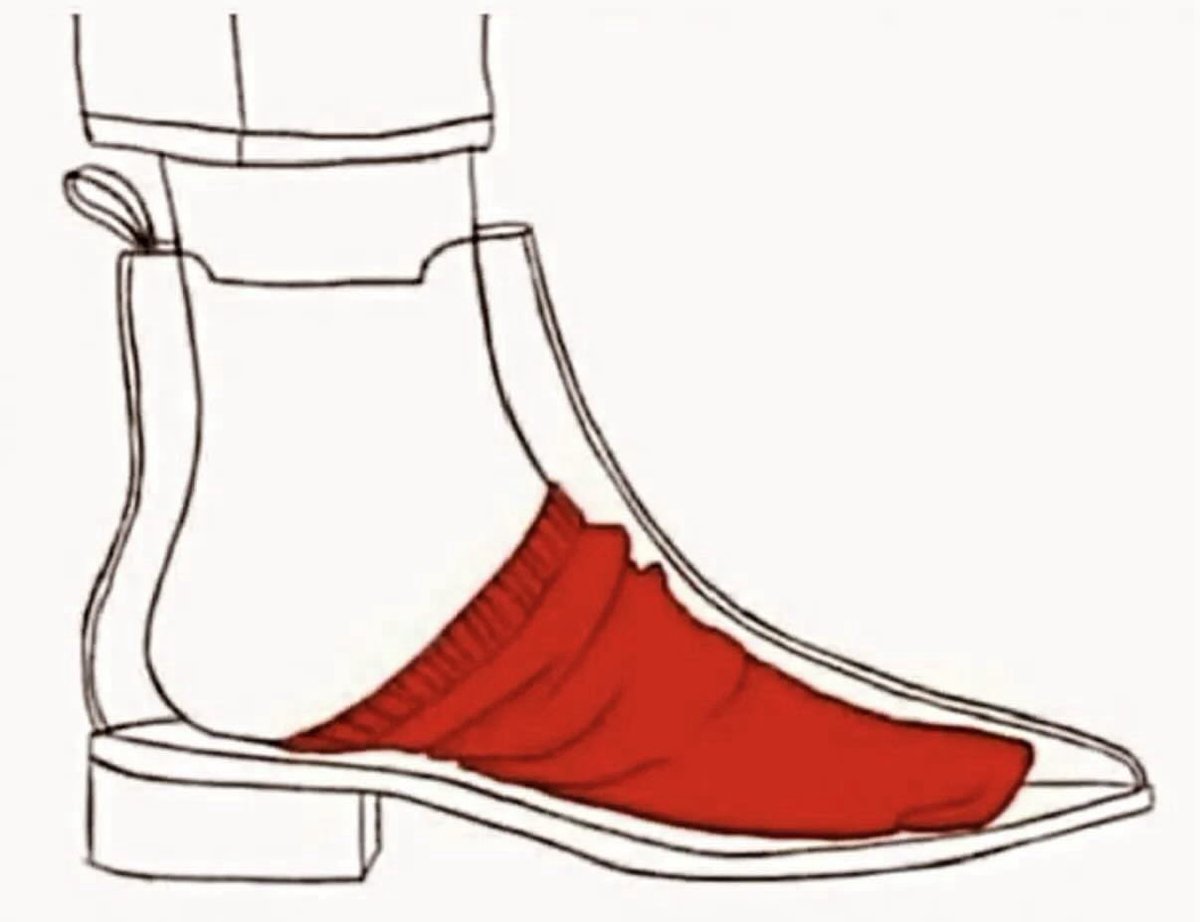 Así es como se ve el sufrimiento…