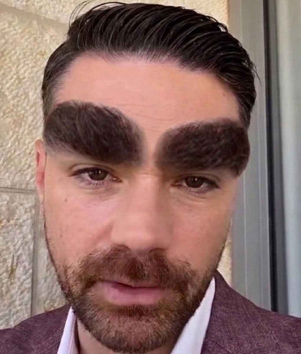 Allen_Josiah11's tweet photo. @baroncoleman What happens when Ben takes a viagra? 

His eyebrows get bigger. https://t.co/NkInwcNax0