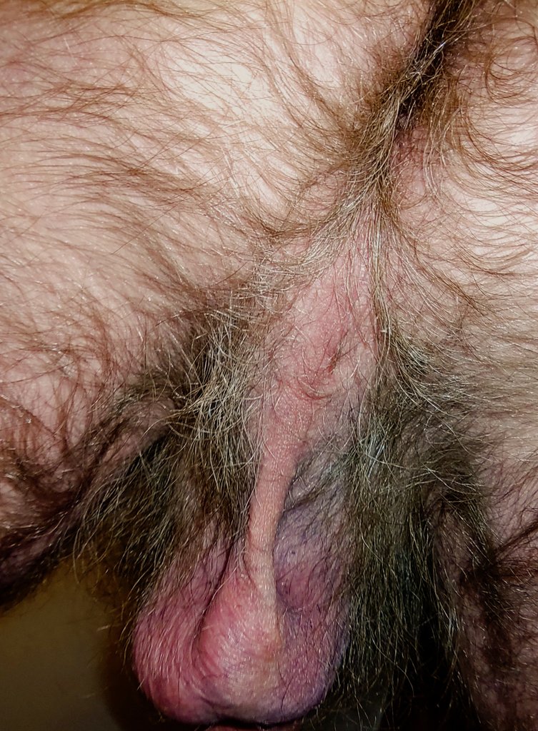 hairy legs tweet media