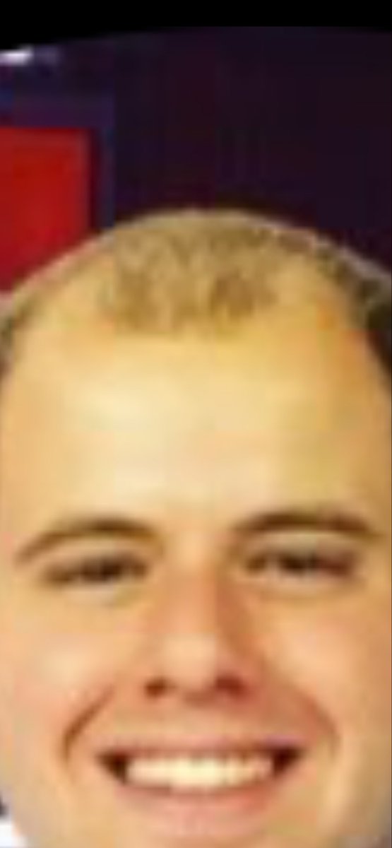 tylershack's tweet photo. @E_Dilla Not as massive as his recedding hairline https://t.co/WNDxjCJtXa