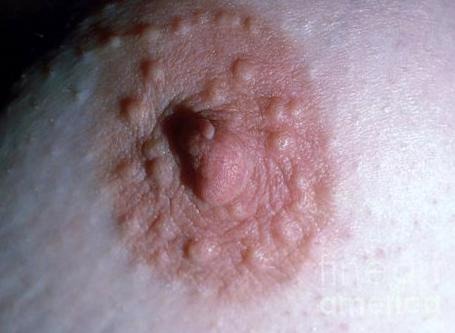 ناصر tweet media