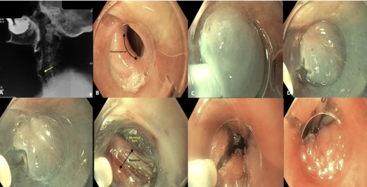 Indian Journal of Gastroenterology tweet media