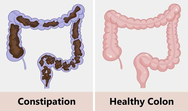 TrascendenciaX_'s tweet photo. La limpieza de colon es la intervención de salud más poderosa, pero a menudo ignorada.

Soluciona la fatiga crónica, los problemas de la piel y el sistema inmunitario débil.

Lo he probado yo mismo y hace maravillas.

Aquí te explicamos cómo realizar una limpieza de colon correctamente: 🧵