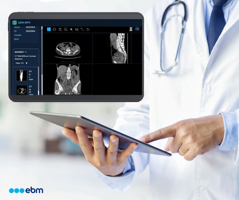 EBM_Tech's tweet photo. EPS Pi - Multi-Planar Reconstruction:
 • Converts CT slices into X, Y, and Z planes
 • Allows visualization from frontal, sagittal, and axial perspectives
 • Supports more accurate spatial interpretation for diagnosis and treatment planning

#EBMTechnologies #MPR #Radiology https://t.co/vZ4KzSrXhb