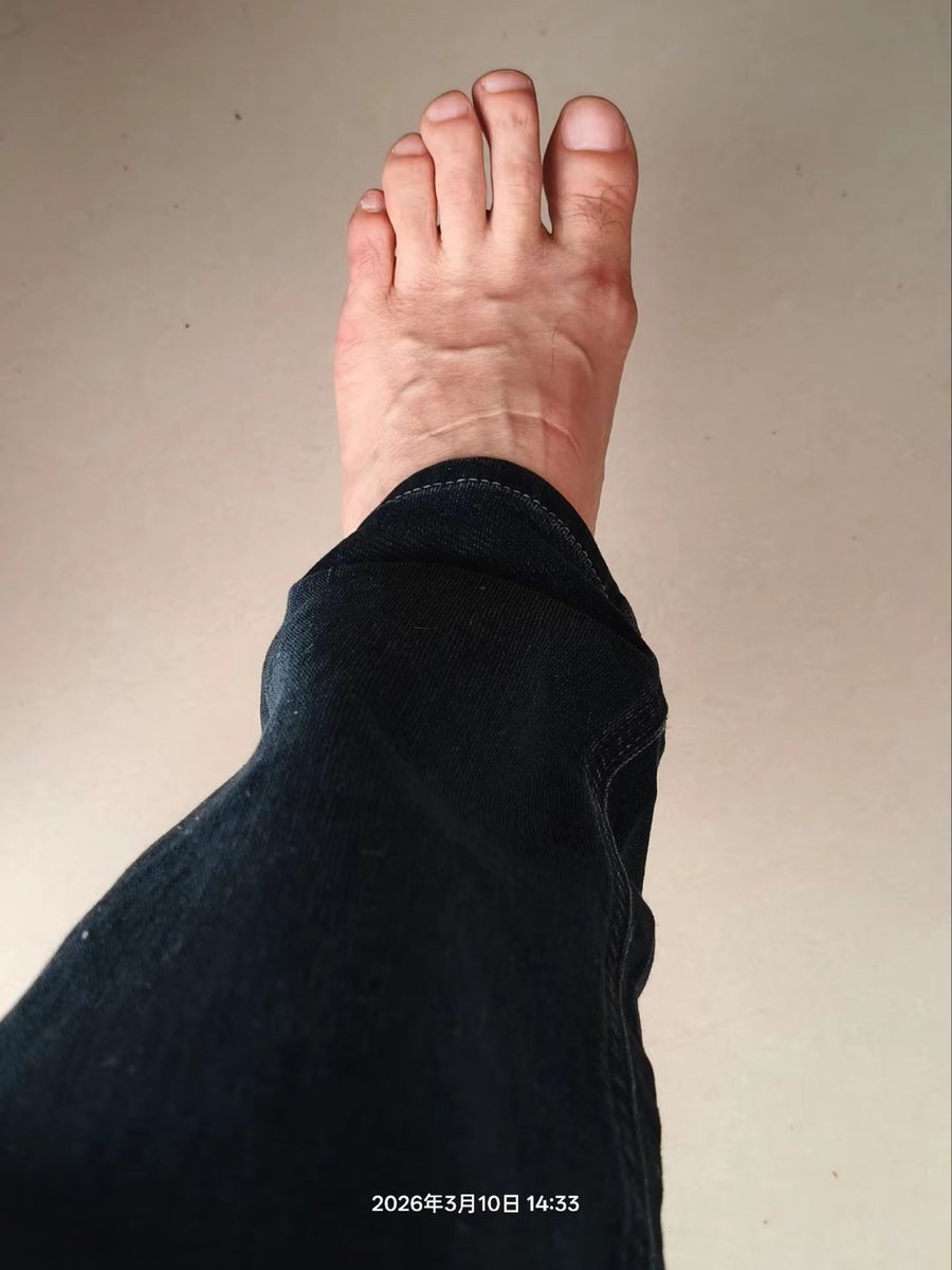 热了