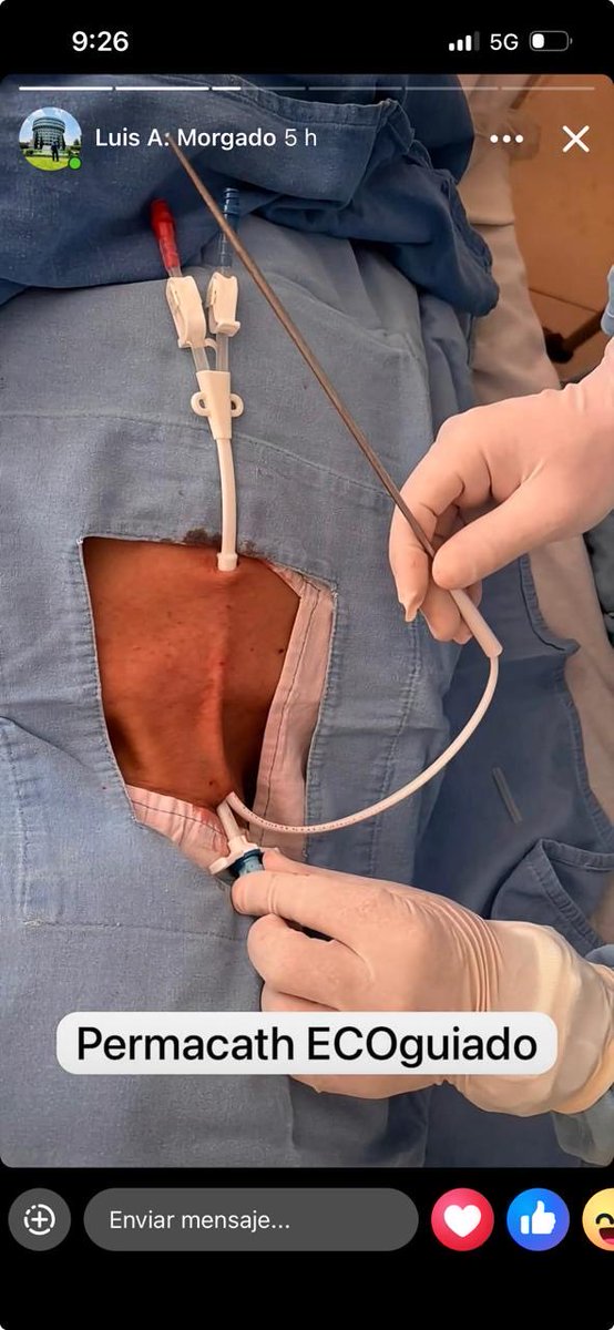 Riñón Ácido tweet media