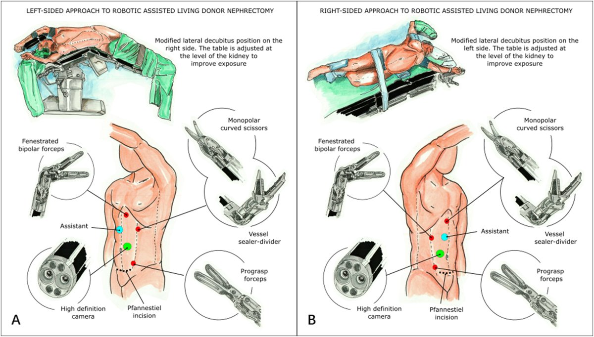Laparoscopic, Endoscopic and Robotic Surgery tweet media