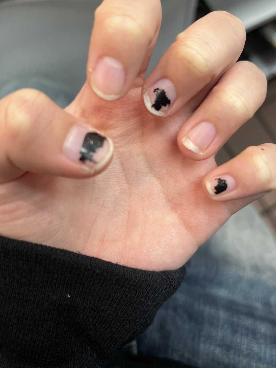 ok guys I’m excited to announce at the expense of my epidermis and dermis my nail biting has decreased significantly this past months and they’ve grown way more than they ever have since 2017