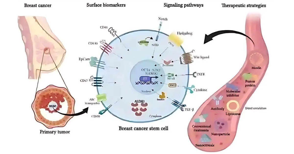 IVERMECTIN 15mg should be given to ALL Advanced Breast Cancer patients - outperforms chemo Paclitaxel and kills Cancer Stem Cells!

A 2017 bombshell study by Mexican researchers should have changed how Breast Cancer is treated. Forever.

In the 2017 paper "Ivermectin as an
