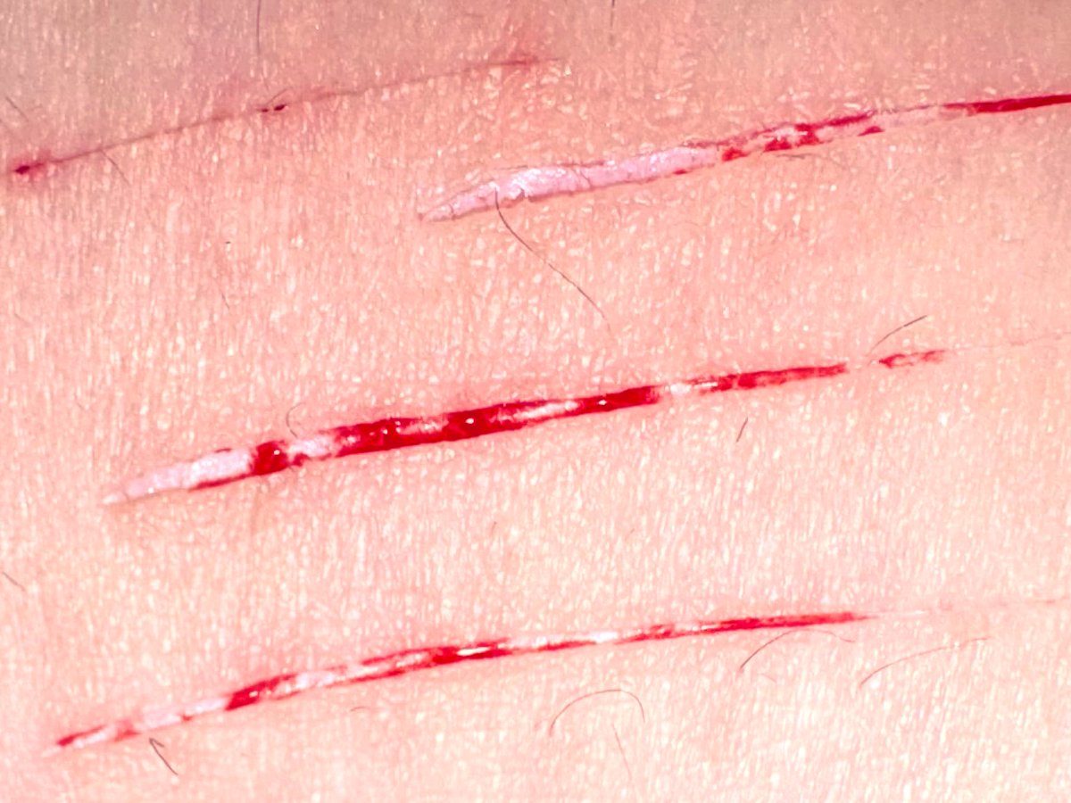 shrinky330's tweet photo. do not mind my nasty ass scabs , ANYWAY styrooo  (also ignore my hairy legs)#shtwt https://t.co/Uw69CU5lr5