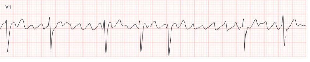 CardiovascularCorner tweet media