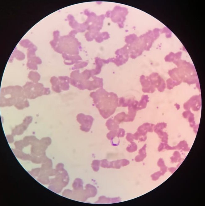 Dr. Fred C. Semitala tweet media