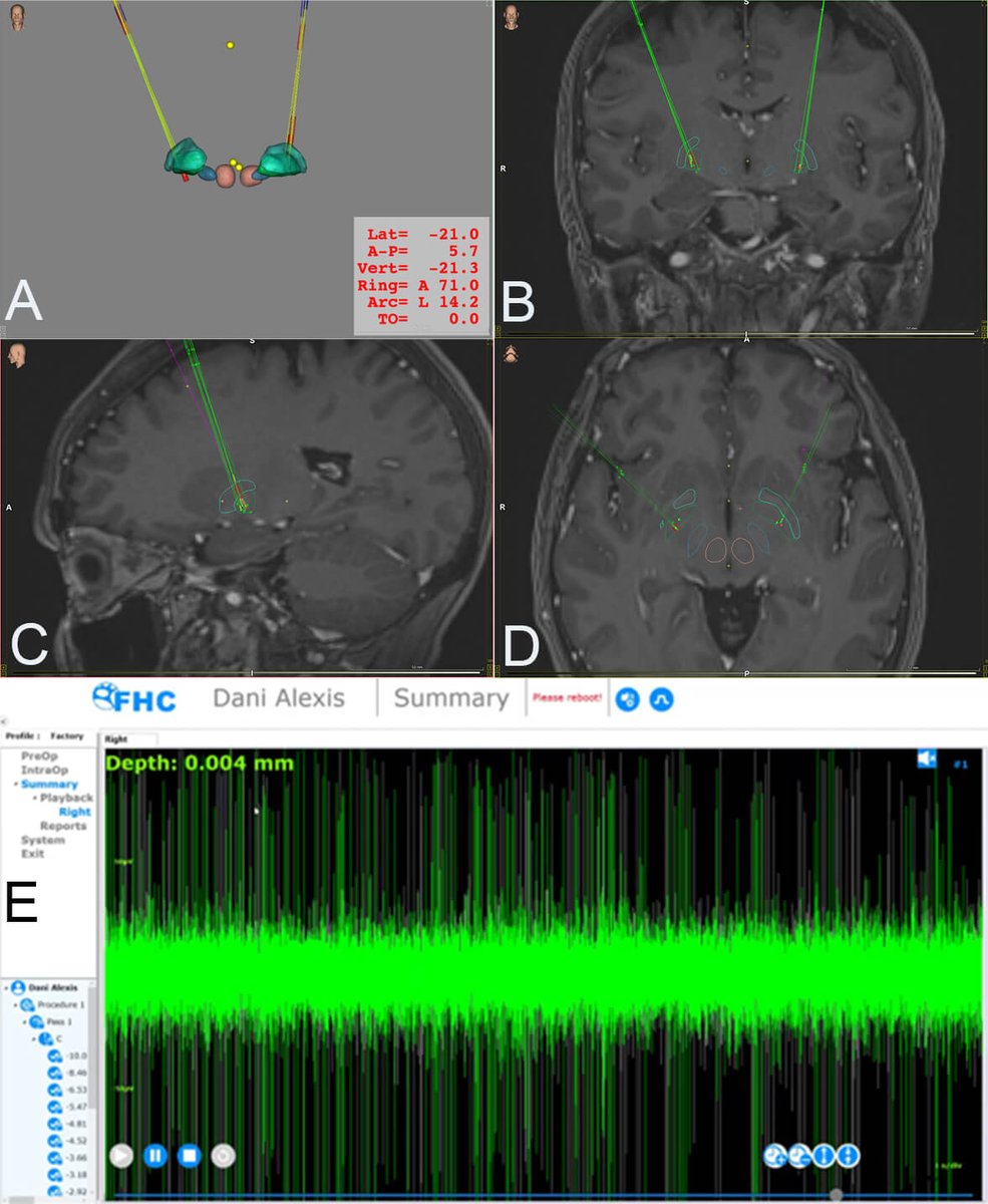Revista de Neurología tweet media