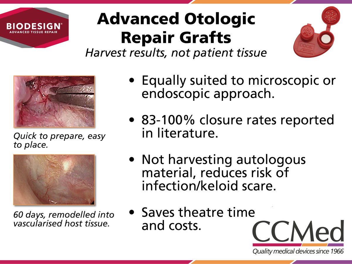 CcmedUk's tweet photo. Otologists all over the UK and Ireland trust Biodesign to provide great closure rates without having to harvest host tissue. 

Saves time &amp; costs with great outcomes!

Visit https://t.co/IOg056bdhr 

#ENT #otologist #otology #tympanoplasty #tympanic-membrane #tissue-repair https://t.co/OuBRNmEyUd