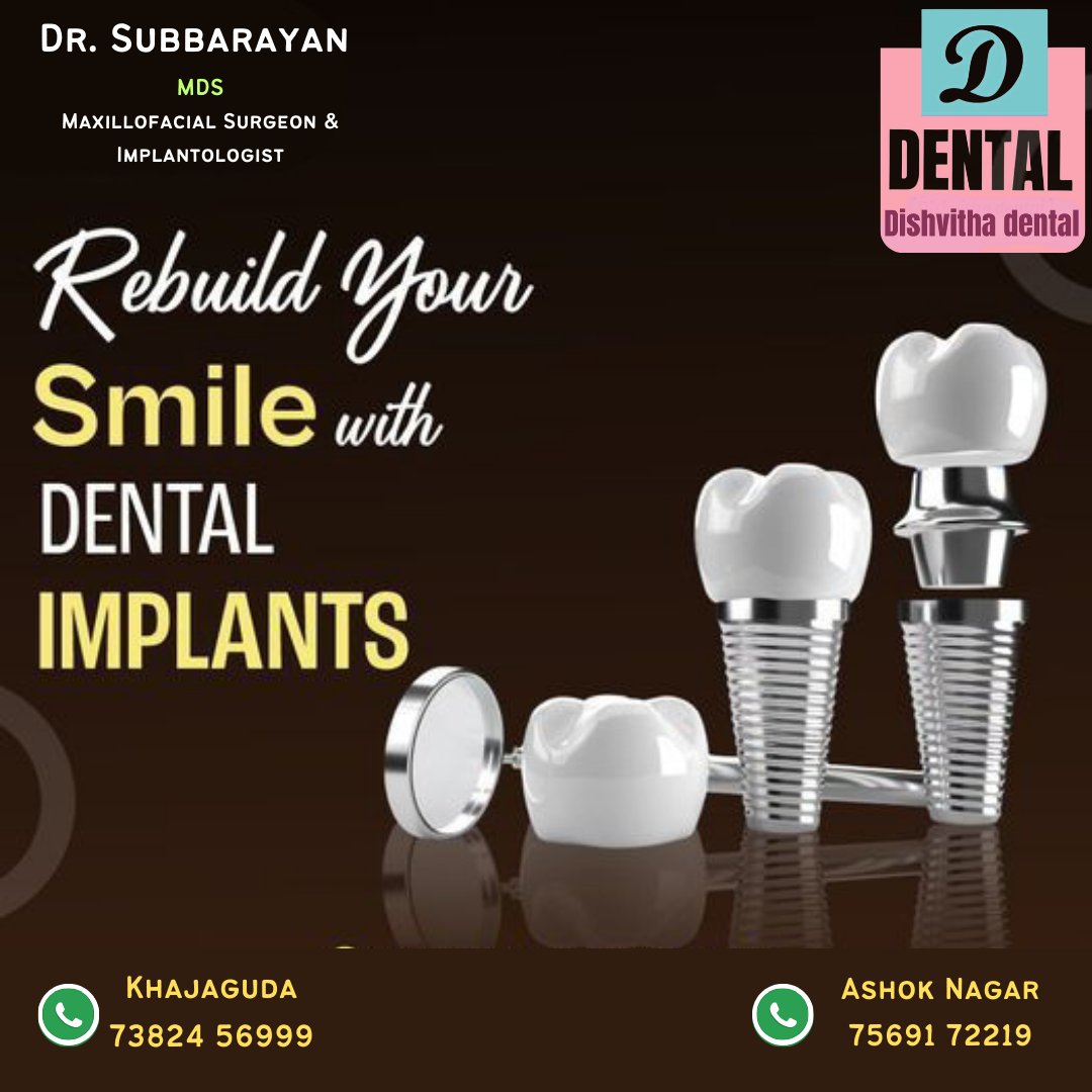 DDishvitha's tweet photo. Best Dental Hospital In Ashoknagar - Hyderabad. #ashoknagar #hyderabad #narayanguda #himyathnagar #chikkadpally #rtcxroads #hyderabaddentist #dentalhyderabad #hyderabaddentalclinics #dentalclinicsofhyderabad #domalguda #secunderabad #indirapark_hyd #IndiraPark #khajaguda https://t.co/DUtRcBgzDx