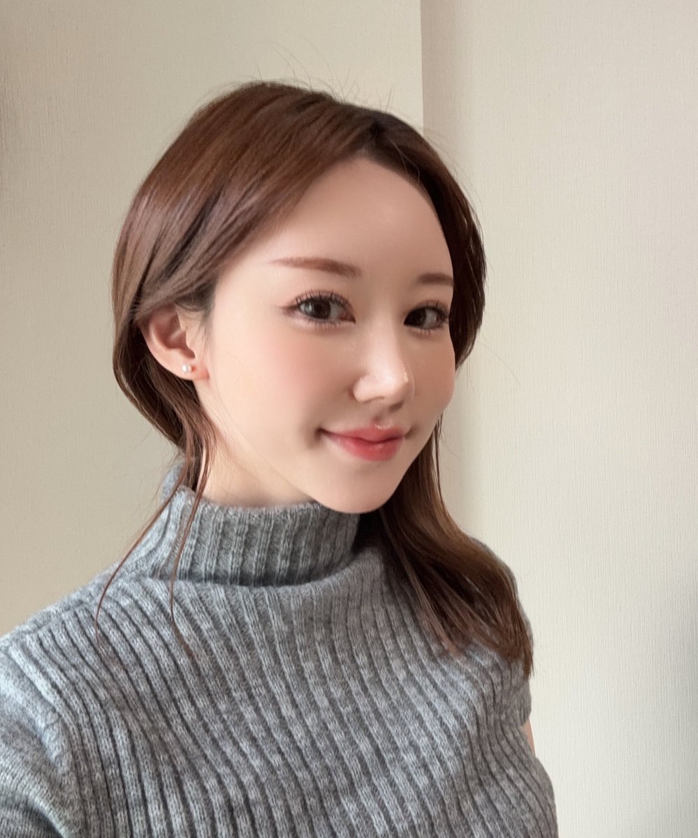 整形ぱんだ🐼ポニーテールリフト、脂肪移植DT中 tweet media