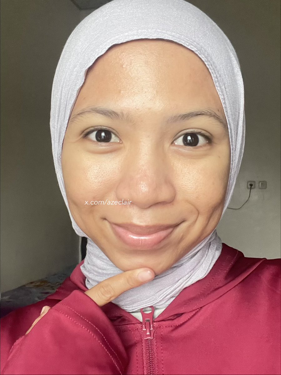 azeclair's tweet photo. nurut kata dokter buat fokus “calming skin” and tadaa~

my skin gets better🥺🫰🏻 https://t.co/RdLY8Qgy3X