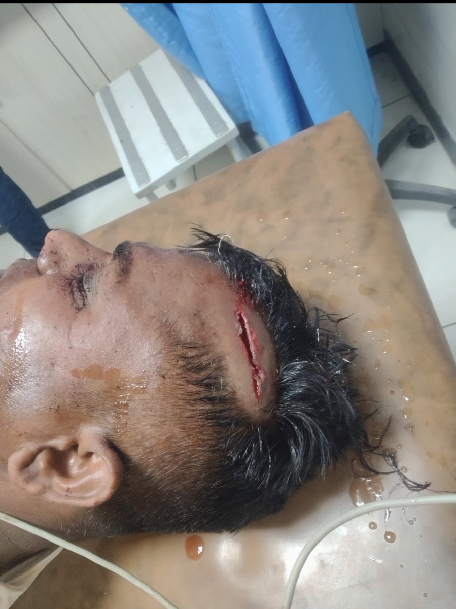 #जालोर बागोडा प्रशासन की लापरवाही से निर्दोष अस्पताल पहुँच गया SC/ST एक्ट के तहत केस दर्ज होने के बावजूद अपराधियों ने दोबारा हमला करने की हिम्मत कैसे की? क्या पुलिस आरोपियो को सरक्षण दे रही है?
से निवेदन है कि इस मामले में हस्तक्षेप करे और पीड़ित को न्याय दिलाए
<a href="/RajPoliceHelp/">Rajasthan Police HelpDesk</a>