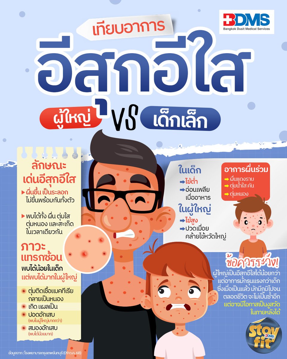 PPTVHD36's tweet image. โรคอีสุกอีใสเกิดจากไวรัสวาริเซลลา ติดต่อผ่านไอจามหรือสัมผัสใกล้ชิด มีไข้และผื่นตุ่มใสคันขึ้นเป็นระลอก เด็กมักอาการไม่รุนแรง แต่ผู้ใหญ่เสี่ยงภาวะแทรกซ้อนมากกว่า แพทย์เผยเป็นแล้วเป็นซ้ำได้อีกหรือไม่?
.
อ่านต่อ : pptv36.news/1Pvl
.
#อีสุกอีใส #โรงพยาบาลกรุงเทพจันทบุรี #BDMS