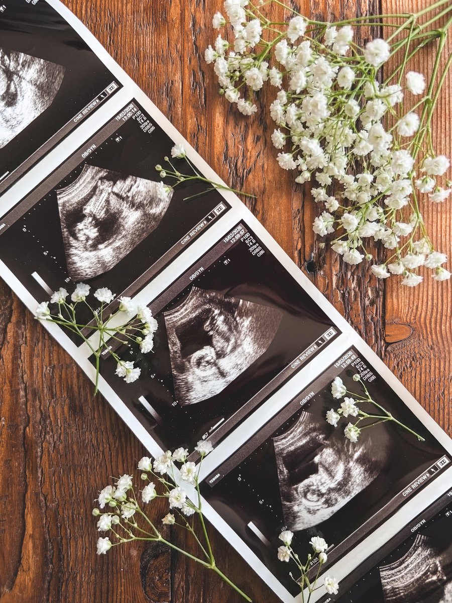 Chris Taylor tweet media