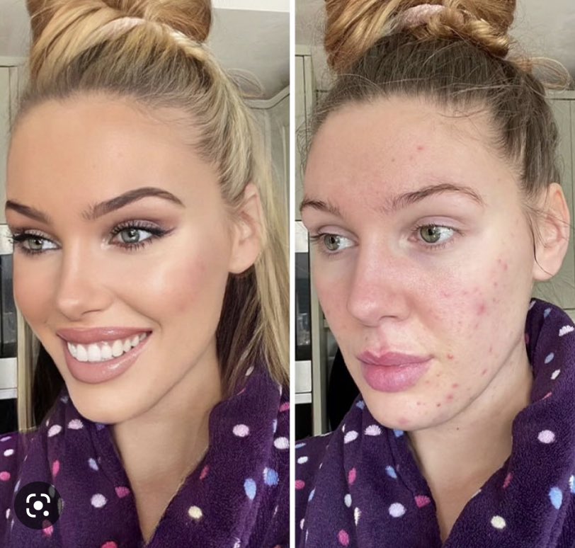 Brian Atlas tweet media