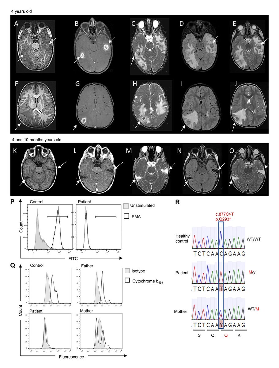 Journal of Human Immunity tweet media