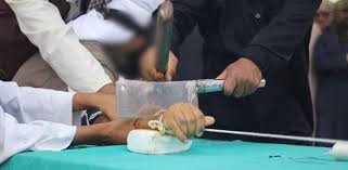 The right hands of all Muslims should be cut off before deporting them back to their country. Call it..."Reverse Sharia Law."