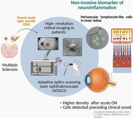 @BrainComms tweet media