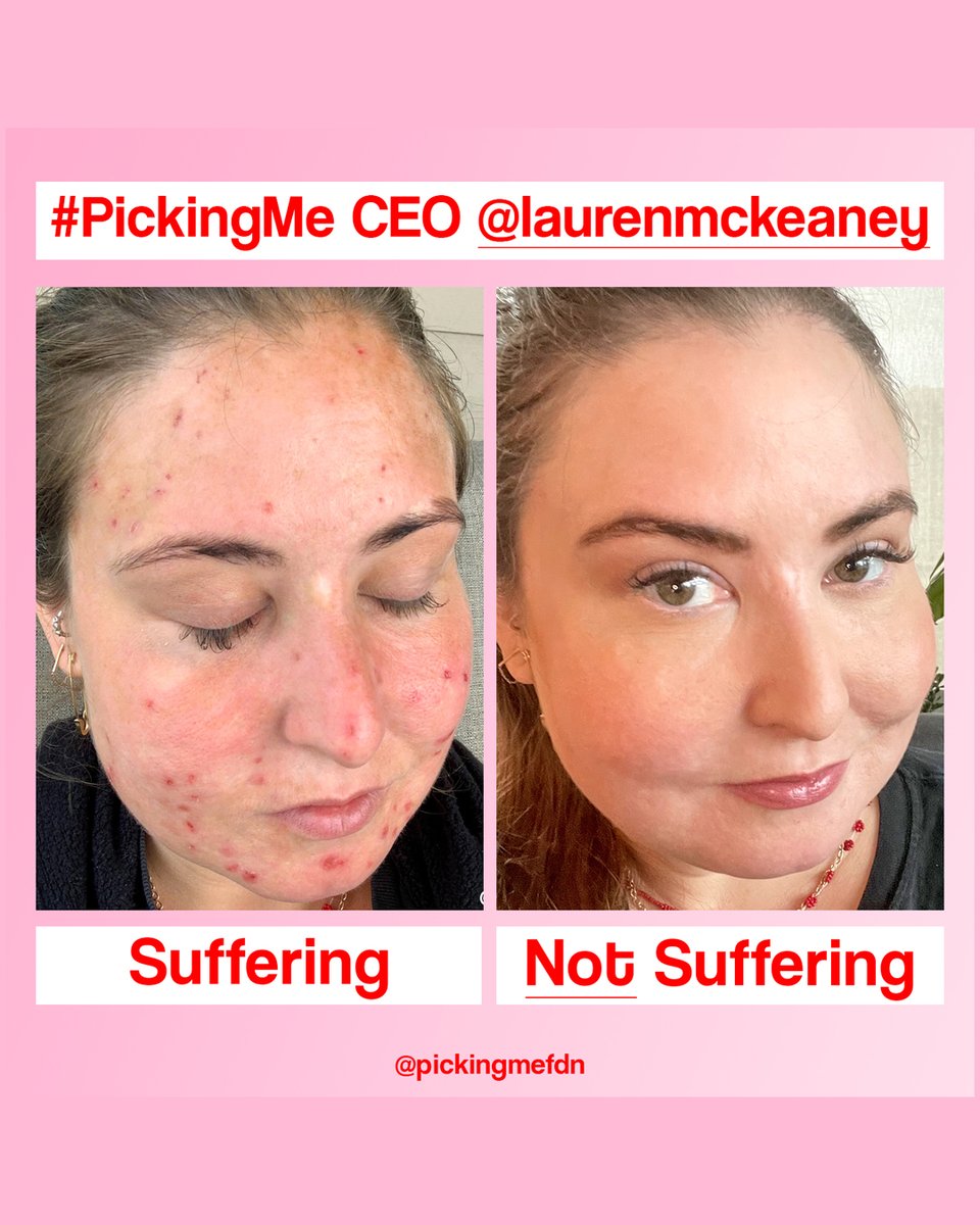 Picking Me Foundation #dermatillomania tweet media