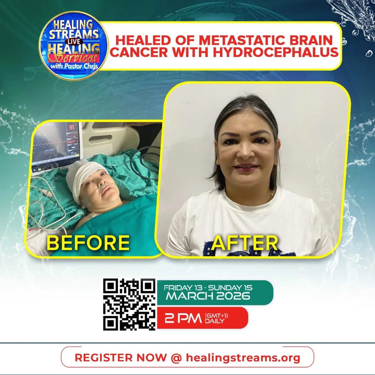 Princesseric33's tweet photo. It’s 3 days to Healing streams live Healing service with Pastor Chris 
Don’t be told what happened 

#HealingStreams
#HSLHSMARCH2026
#IamBlazing
#CELZ1Rocks https://t.co/UydrADfCkP