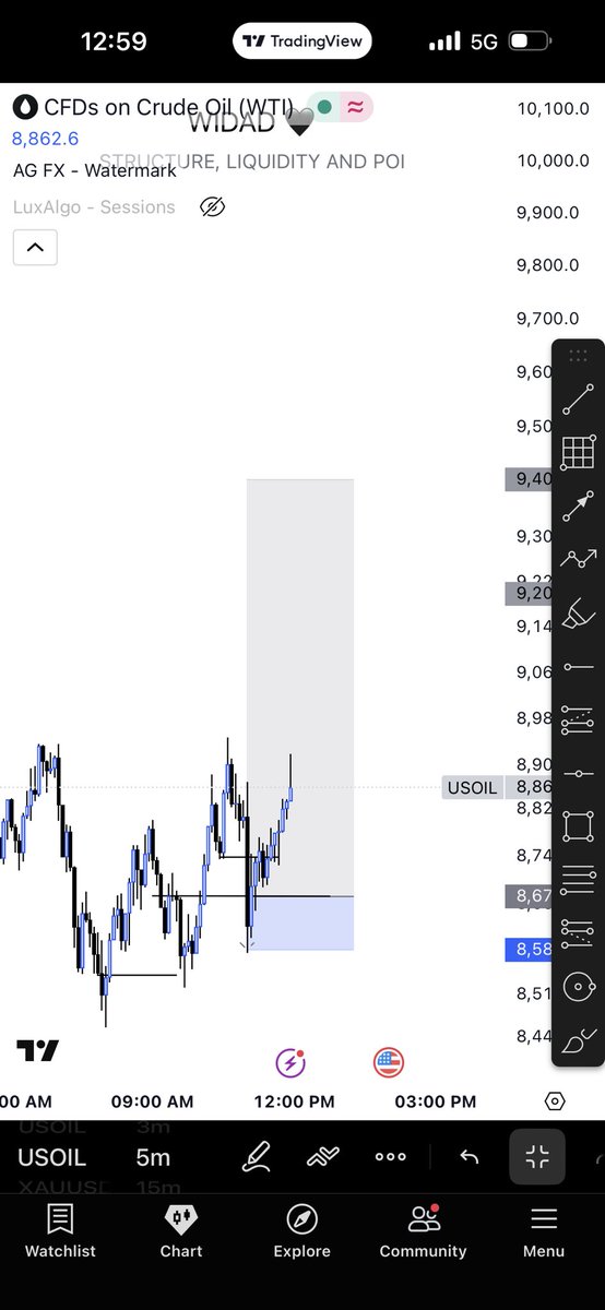 Different type of pain 
#forex #usoil
